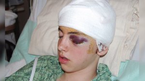 Slattery injury