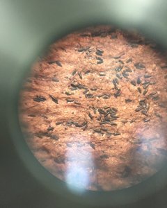 Eggs of the aedes aegypti seen through a microscope. The mosquito lays its eggs in stagnant waters in populated areas, making public awareness one of the main tools of fighting against the epidemic. (Miguel Castro/CNN)