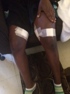 Teen shot in leg following Cavs parade (Courtesy: Peggy Gallek)
