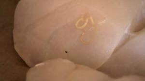 Stefanie Rock says her family discovered “at least two” parasites in one of the fish filets. (KCRA)