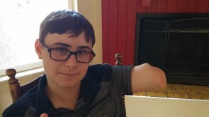 16-year-old Hunter Treschl went to Oak Island, NC, on June 14, 2015, for a day of fun in sand and sea. A shark took his left arm in waist-high water. But Hunter, never one to mope, has forged ahead with his life.