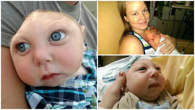Baby born with most of skull missing defies the odds, celebrates first birth
