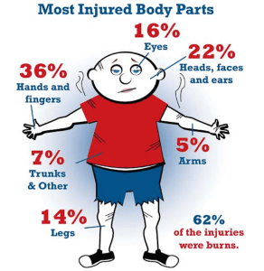 Most Injured body parts