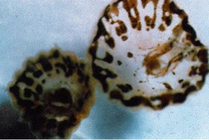The sea lice are actually not-so-cute baby jellyfish that have been invading coastal beaches for more than a century. (Florida Department of Public Health)