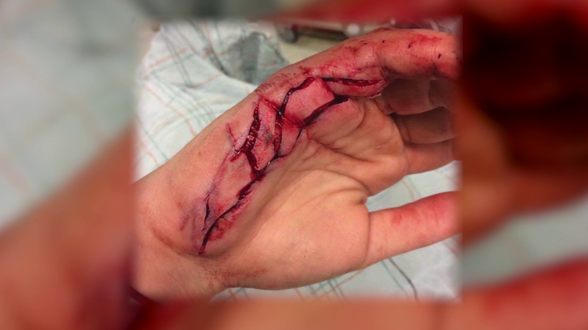 Norman native suing popular blender company after mishap leads to