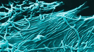 Ebola virus imagery. (Credit: CDC)