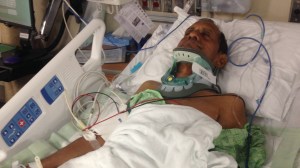 Sureshbhai Patel, 57, required spinal fusion surgery to repair damage to his back when his family says Alabama police twisted his arm and forced him to the ground. (Credit: Patel Family via CNN) 