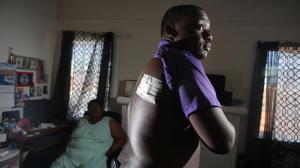 Jamar Nicholson shows the wound where a bullet entered his back. The bullet is still lodged near his spine. (Credit: Irfan Khan / Los Angeles Times)