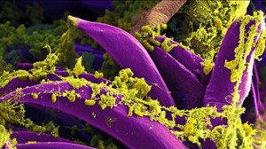 Purple-colored Yersinia pestis bacteria, the bacteria that causes the plague, seen on the spines of a flea. (Credit: National Institute of Allergy And Infectious Diseases)