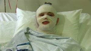 Mason Wells, 19, speaks to CNN after being injured during terror attacks in Brussels on March 22, 2016. 