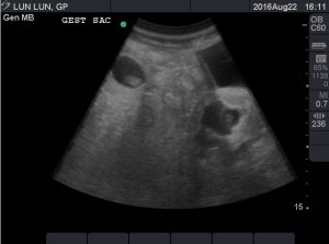 An ultrasound conducted by the zoo's veterinary team on August 18 shows the presence of two fetuses. (Credit: Atlanta Zoo)