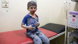A Syrian boy awaits treatment at a make-shift hospital following air strikes on rebel-held eastern areas of Aleppo on Sept. 24, 2016. (Credit: Karam Al-Masri/AFP/Getty Images)