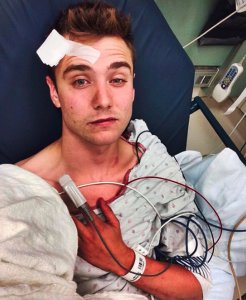 Calum McSwiggan posted this photo of himself on Instagram on June 27, 2016, one day after he said he was attacked by three men in West Hollywood.