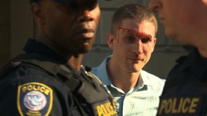 A white nationalist group member was bloodied while confronting a large number of protestors outside the site of a Washington, DC, conference celebrating Donald Trump's presidential victory Nov. 19, 2016. (Credit: CNN)