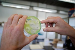 A researcher holding a petri dish with a culture at the microbiology lab of the Universitair Ziekenhuis Antwerpen, a hospital in Antwerp on August 13, 2010. (Credit: JORGE DIRKX/AFP/Getty Images)