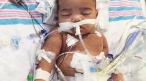 AJ Burgess was born prematurely, his mother says. (Credit: GoFundMe)