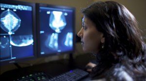 A mammogram image is seen in this file photo. (Credit: Ohio State University Comprehensive Cancer Center via CNN)