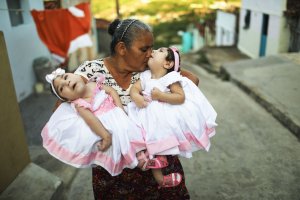 Grandmother Maria Jose holds her twin granddaughters Heloisa and Heloa Barbosa — both born with microcephaly after their mother contracted the Zika virus during pregnancy — outside of their house as they pose for photos at the twins' 1-year birthday party on April 16, 2017, in Areia, Brazil. (Credit: Mario Tama / Getty Images)