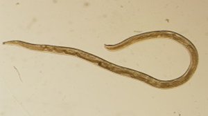 An adult female Thelazia gulosa, after it was removed from the surface of the eye. (Credit: CDC)
