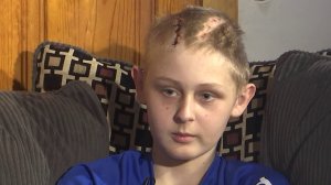 Trenton McKinley is being called a miracle after suffering severe brain trauma from a dune buggy accident. (Credit: WALA via CNN Wire)