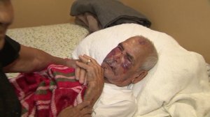 Rodolfo Rodriguez, 92, recovers on July 6, 2018, two days after he was brutally attacked while walking in South Los Angeles. (Credit: KTLA)
