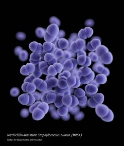 (Credit: Centers for Disease Control)