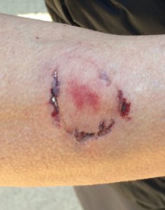 A woman was bitten by another woman after she sprayed the suspect's dog with pepper spray to fend of an attack at Anthony Chabot Regional Park in Castro Valley on Jan. 3, 2019. (Credit: East Bay Regional Park District Police Department)