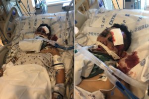 A 45-year-man named Esteban is seen in the hospital after being struck by a hit-and-run driver while on his bicycle in South Los Angeles on March 28, 2019. (Credit: L.A. Police Department)