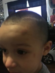 Damien Ventura is seen with facial injuries in an undated cellphone photo his father Oscar took released by the Claypool Law Firm on March 1, 2019.