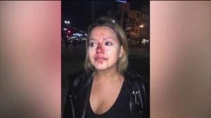 A woman said she suffered a broken nose after being punched by a man at a bar in Long Beach on April 16, 2019. (Credit: Courtesy)