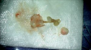 tapeworm
