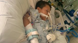 Aaron Carreto, 10, of Compton, pictured after a fireworks accident that cost him one of his hands on his 10th birthday on July 6, 2019. (Credit: Carreto family)