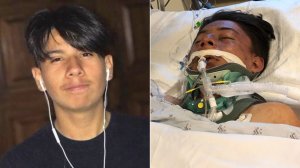 Roberto Diaz is seen in an undated photo provided by his mother, left, and a photo provided by family from his hospital bed after being critically injured in a hit-and-run crash on Aug. 6, 2019.