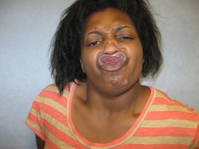 duck face mugshot